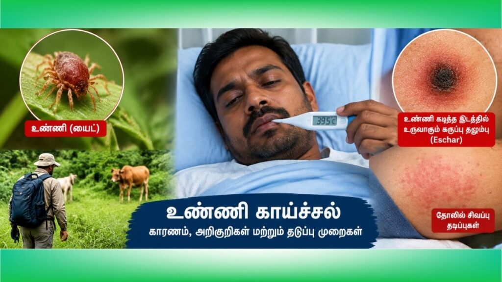 தமிழகத்தில் உண்ணி காய்ச்சல் பரவல்: அறிகுறிகளை அலட்சியம் செய்ய வேண்டாம்!